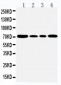 Anti-GRP78 BiP Antibody